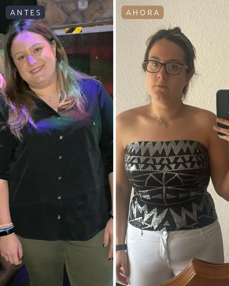 Antes y después de Nerea